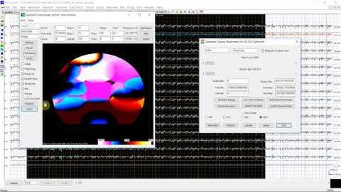 MEG/EEG Time Frequency Analysis 08