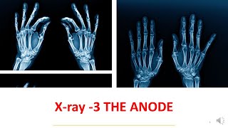 نيوكليون | X-ray -3 الأشعة السينية الجزء الثالث (القطب الموجب)