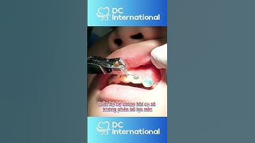Cách Xử Lý Khi Mắc Cài Niềng Răng Bị Bung: Hướng Dẫn Từ Chuyên Gia | Bác sĩ Cường
