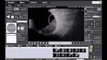 Performing 10 MHz B Scan with the Ellex Eye Cubed