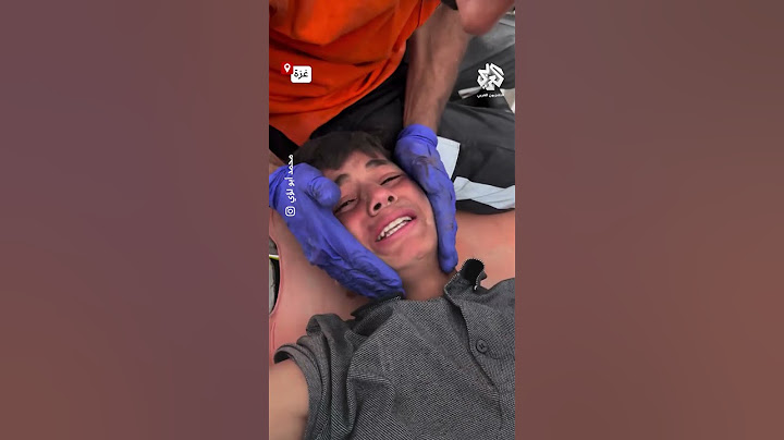 "بدي أروح أجيب طحين لأهلي".. طفل خرج ليجلب الطحين لأهله وأصيب قبل الحصول عليه