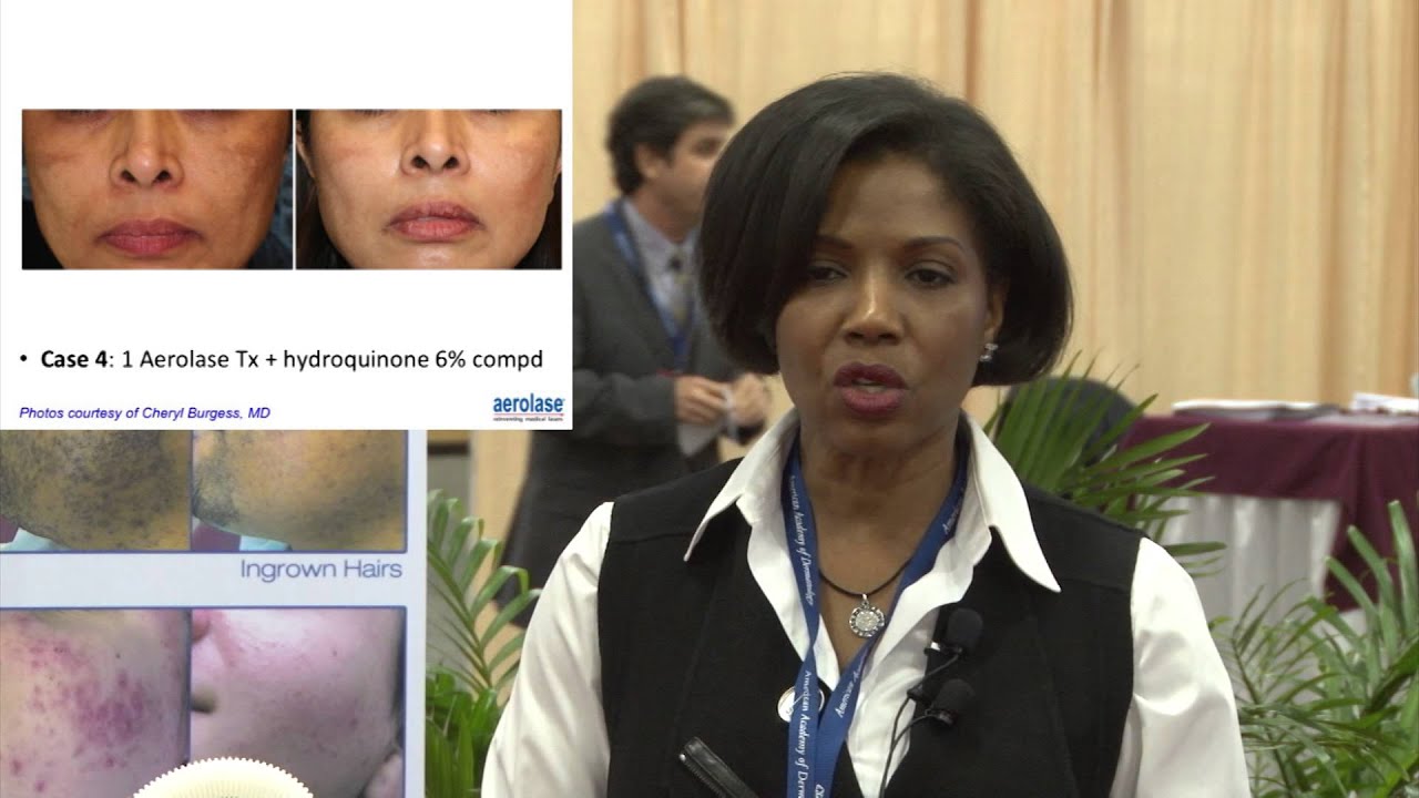 My Go-To Laser:  Dermatologist Cheryl Burgess, MD at the American Academy of Dermatology