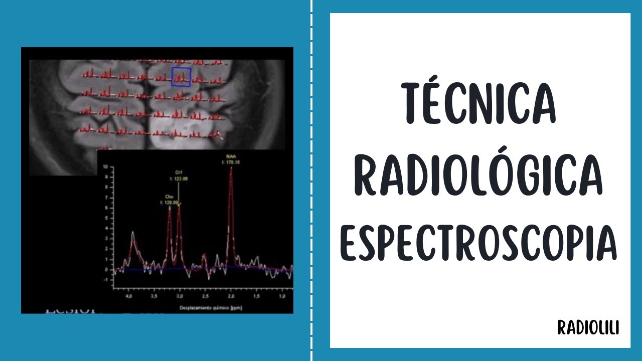 Espectroscopia por Resonancia Magnética: Técnica Radiológica.