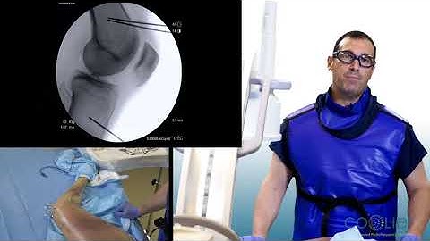 COOLIEF Knee Cooled RF Training Presentation