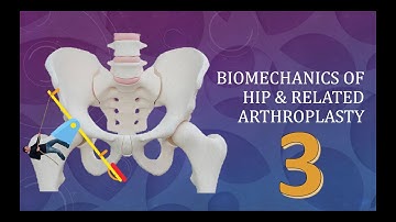 Hip Joint Biomechanics and arthroplasty: Simplified Basics Part 3 of 3