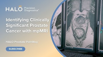 mpMRI Is a Paradigm Shift in Prostate Cancer Diagnostics