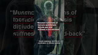 How Can Massage Help Thoracic Spondylosis Pain?