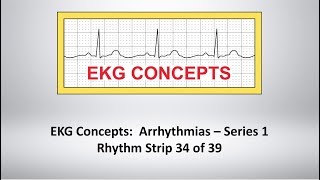 Details EKG Concepts: Arrhythmias Course - Strip 34 of 39 Update