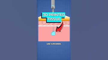 Scientists Create 3D Printer for Inside Your Body...