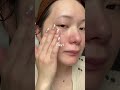 レベルMAX🚨流行りのニードルセラムの変化が凄い..!! #美容 #カタン #カタンダーマヒットセラム #スキンケア #skincare #垢抜け #katan