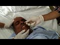 RYLES TUBE/Nasogastric tube insertion