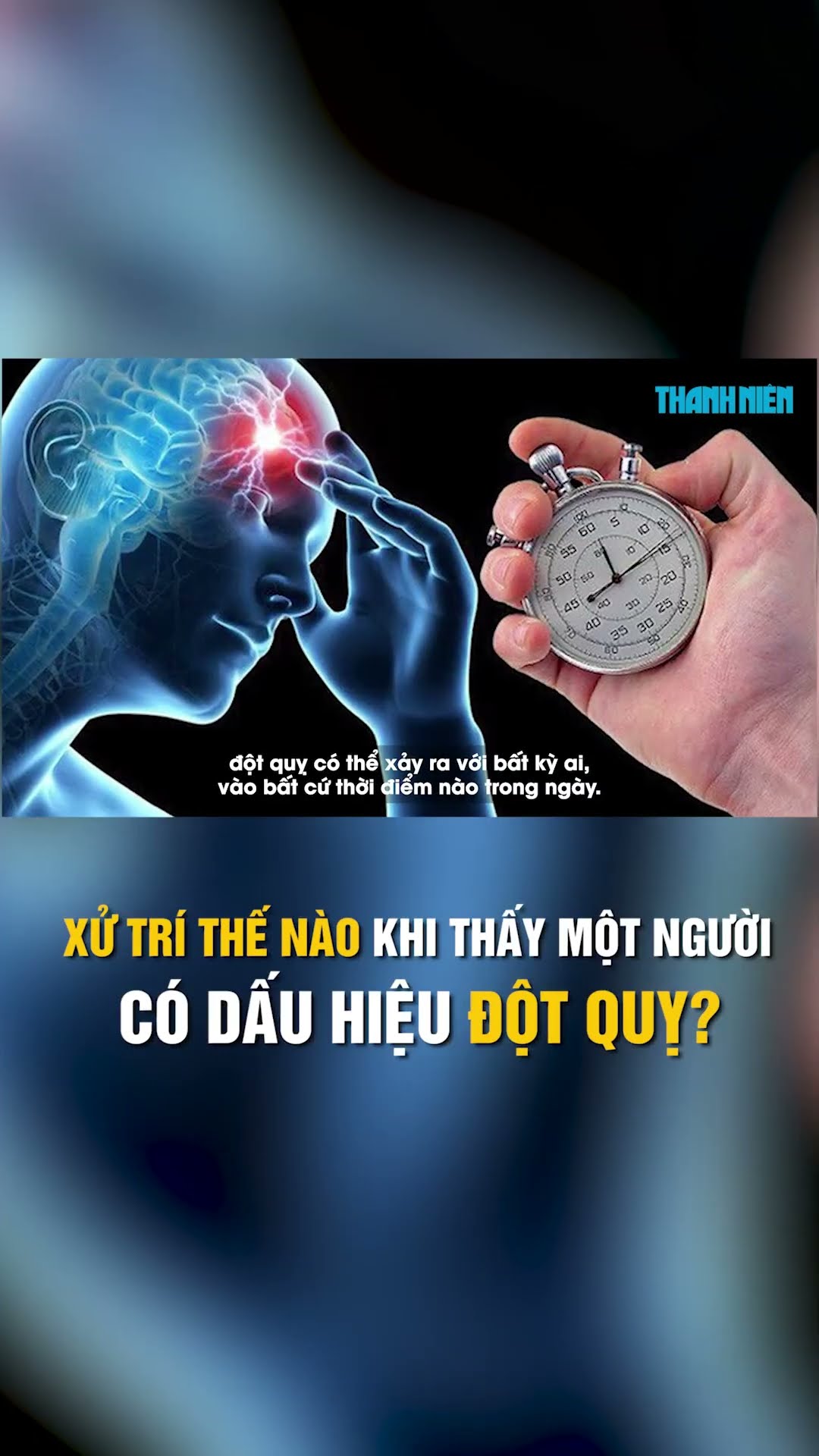 Bất ngờ thấy người có dấu hiệu đột quỵ, nên xử trí thế nào?