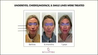 Sherman Oaks Medical Spa - In-office Treatment