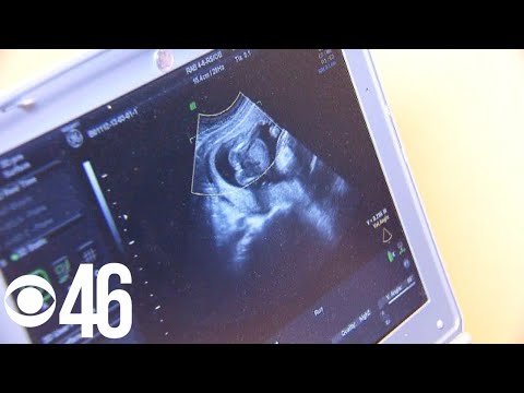 Fulton County DA requests Georgia’s Heartbeat law to be sent to lower courts