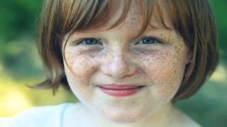 Why Do We Get Freckles And Birthmarks?