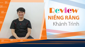 [Review niềng răng]: #142 Kết quả niềng răng của Khánh Trình