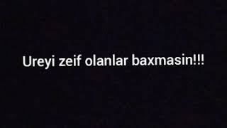 Ureyi zeif olanlar baxmasin!!🔞🔞 Usaglar baxmasin!!🔞🔞