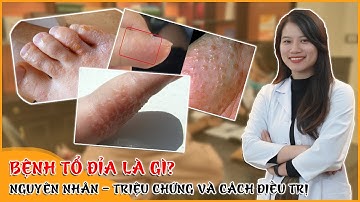 TỔ ĐỈA | Bệnh Tổ Đỉa Là Gì? Nguyên Nhân, Triệu Chứng Và Cách Điều Trị Căn Bệnh Tổ Đỉa