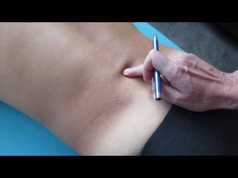 1   Anatomische Orientierung Lumbosacralregion