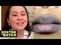 Solusyon sa Maitim ang Labi - Payo ni Doc Liza Ramoso-Ong #80b