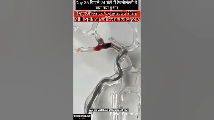 Day 25 : Milli Spinner: Tiny Device That Spins Away Blood Clots! #innovation #blood #humanscience