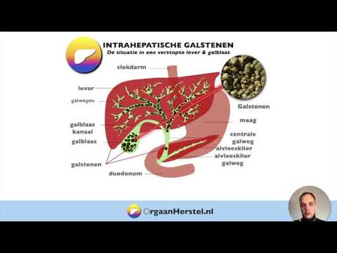 De lever en galblaas zuivering van Andreas Moritz - Uitgebreide Instructievideo