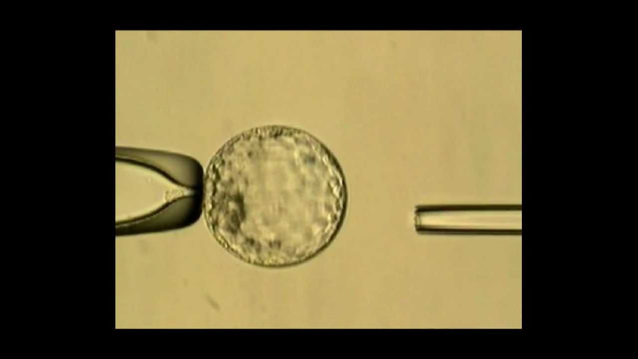 Trophectoderm Biopsy using ZILOS-tk Laser - YouTube