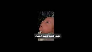 صوت تزيق من صدر الطفل نتيجة  تلين الحنجرة