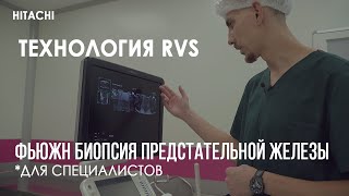Фьюжн биопсия предстательной железы (для специалистов). Технология RVS