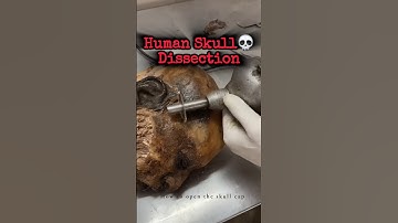 Human Skull Dissection #shorts #ytshorts #viralshorts