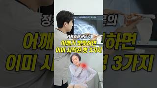 어깨가 뻣뻣하다면…이미 시작된 병, 3가지😰 #어깨통증 #오십견 #회전근개파열