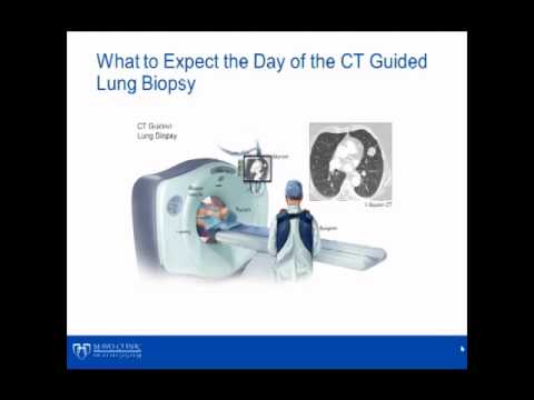 CT Lung Biopsy