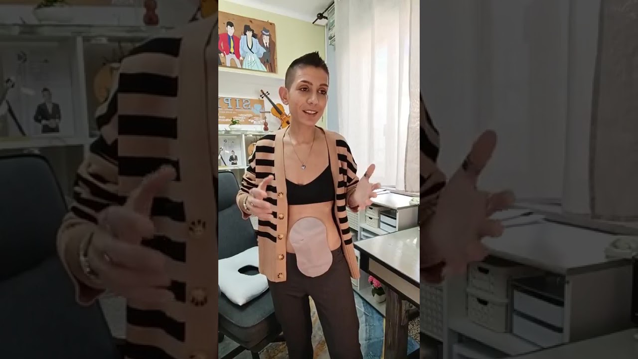 Messaggio per tutte le persone stomizzate o affette da patologie - SPECIAL LIVE PARTICOLARE