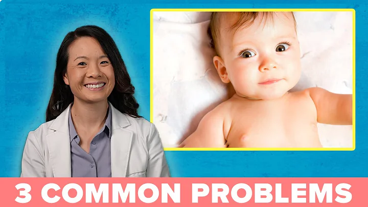 3 Common Eye Problems in Babies