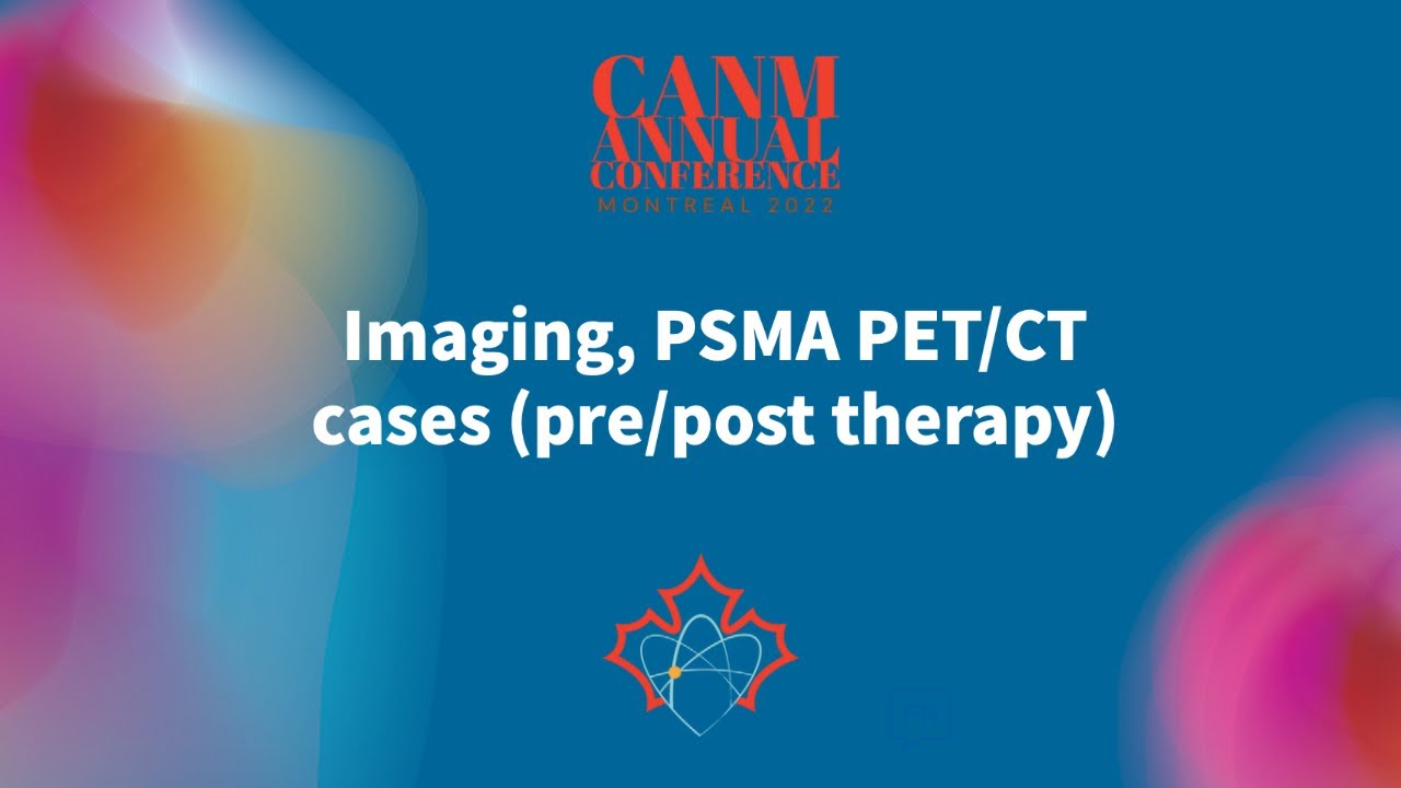 Imaging, PSMA PET/CT cases (pre/post therapy) - YouTube