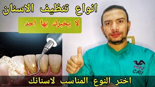 انواع تنظيف الاسنان عند طبيب الاسنان اختر النوع المناسب لاسنانك