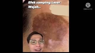 CARA MENGATASI EFEK SAMPING #LASER WAJAH #rifskinskincare