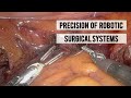 Precision of Robotic Surgical Systems