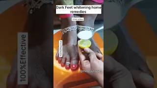 ?Dark Feet whitening home remedies ?| easy pedicure at home| shorts ytshorts skinwhitening