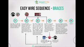 Easy Straightwire Braces Org Chart