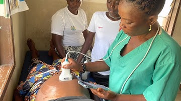 BabyChecker: Artificial Intelligence Ultrasound