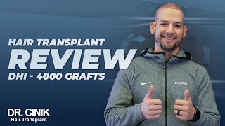 Dr.cinik Hair Transplant Dhi 4000 Grafts Patient Review