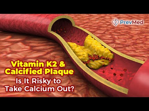 Vitamin K2 & Calcified Plaque - Is It Risky to Take Calcium Out?