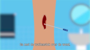 EMC Mail WondUitstrijk Variant2 MetSubs