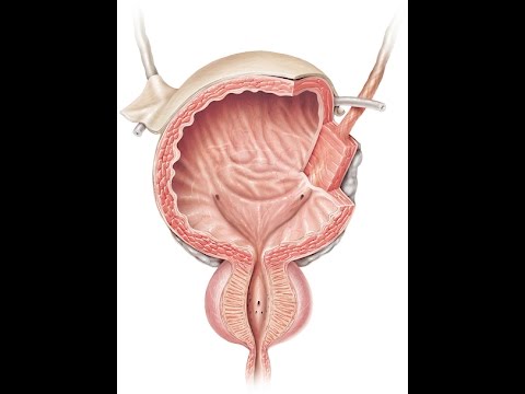 Βίντεο: Τι προκαλεί τις πέτρες στην ουροδόχο κύστη;