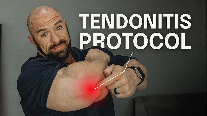 How I Fixed Tricep Tendonitis Without Deloading (Train Through Pain Safely)