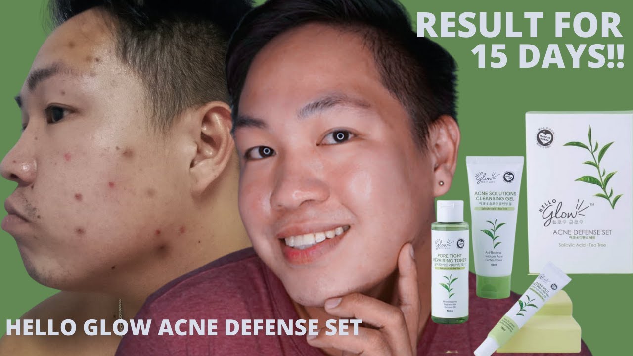 hello glow acne defense set