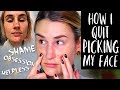 HOW I STOPPED PICKING MY FACE: From Self Abuse To Self Love