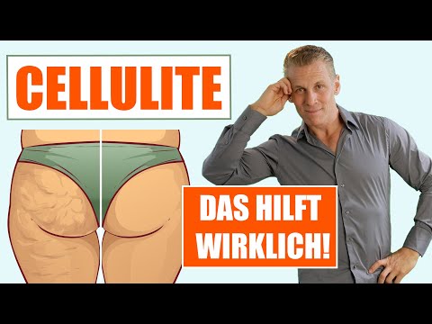 Video: Cellulite Loswerden: Ernährungstipps