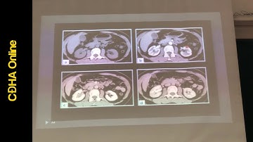 CT Hệ tiết niệu